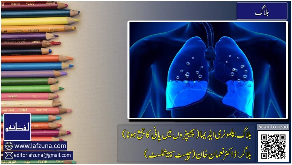 Blogger Doctor Noman Khan Chest Specialist
