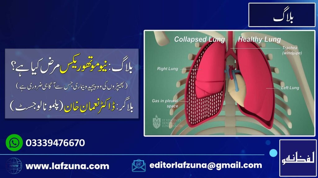 Blogger Doctor Noman Khan Pulmonologist