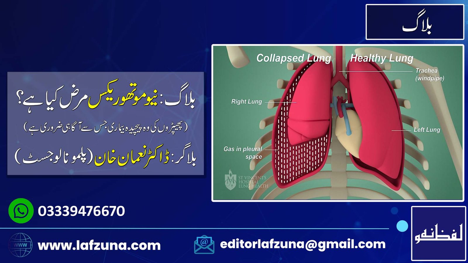 Blogger Doctor Noman Khan Pulmonologist