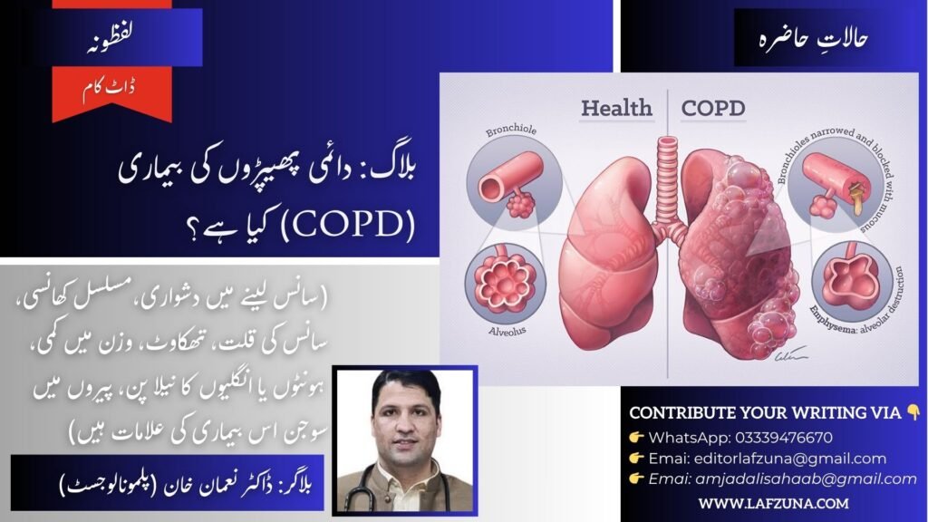 Blogger Doctor Noman Khan Pulmonologist